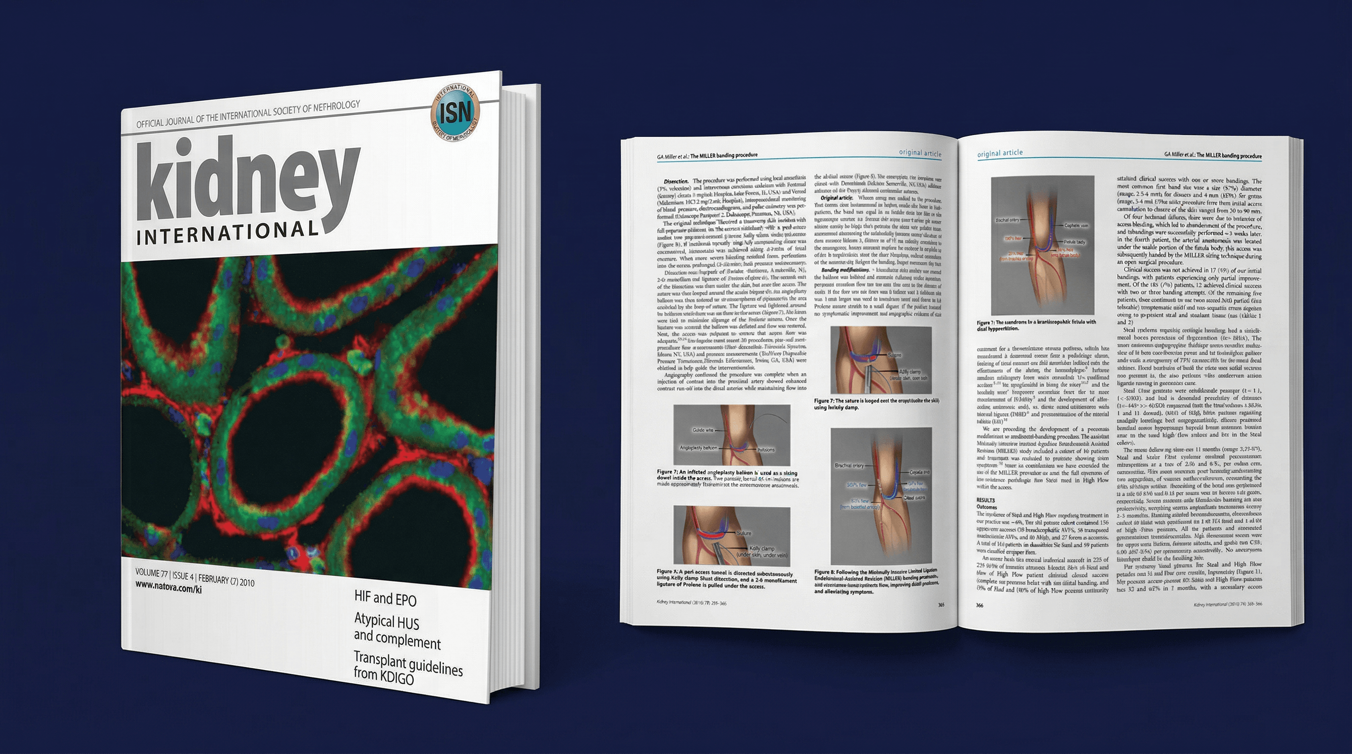 Kidney International, MILLER Banding Procedure publication