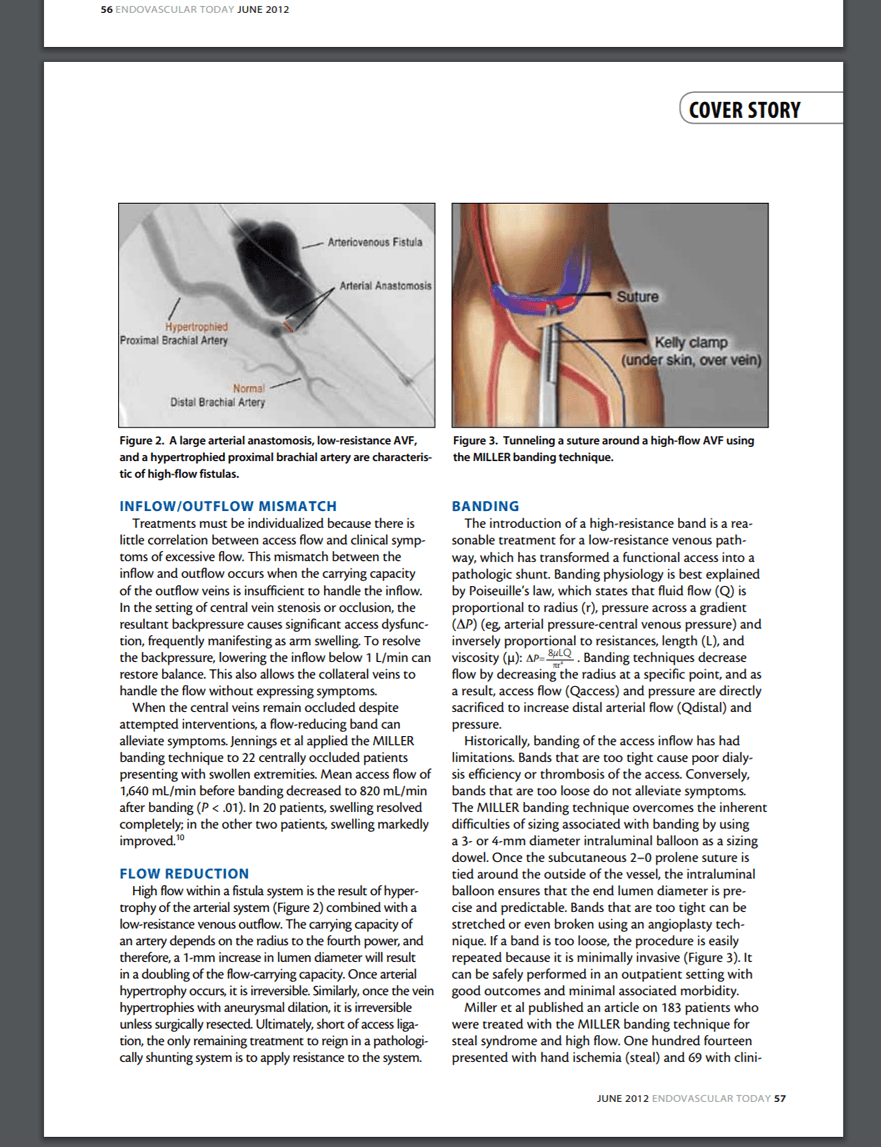 MILLER Banding Procedure medical journal screenshot